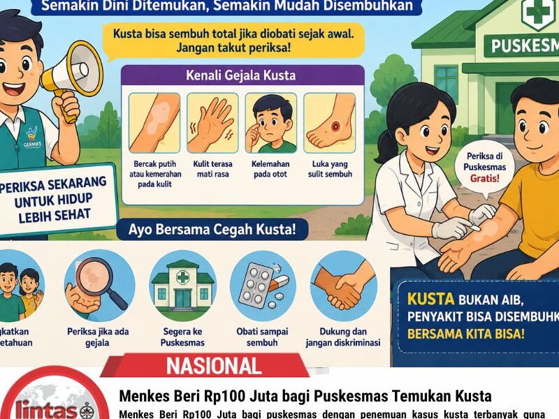 Menkes Beri Rp100 Juta bagi Puskesmas Temukan Kusta