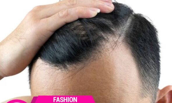 Kenali Penyebab Rambut Makin Tipis dan Berisiko Botak